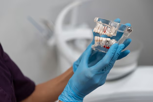 Dental Implants at Dental Rootz