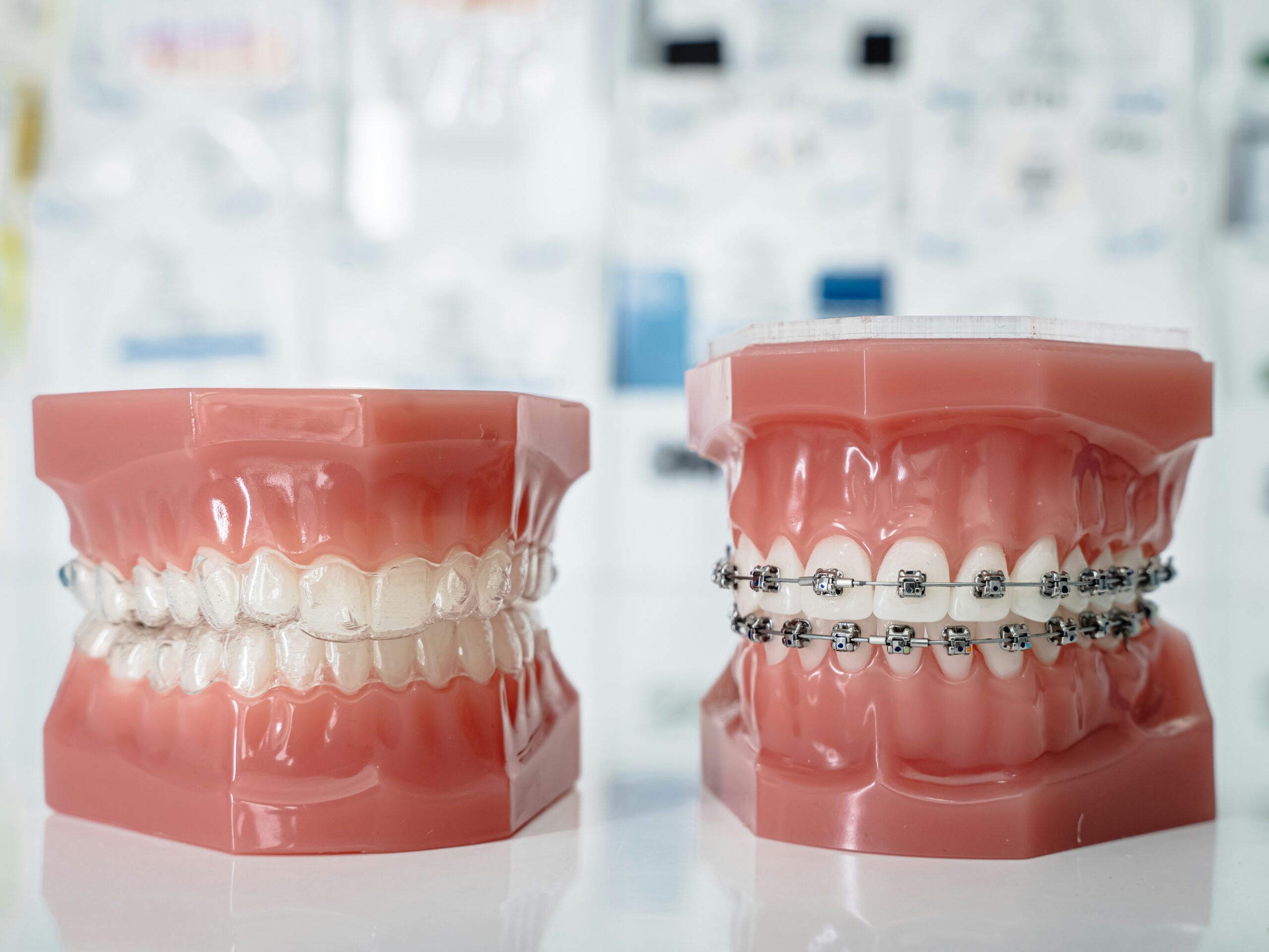 Braces & Aligners Specialist