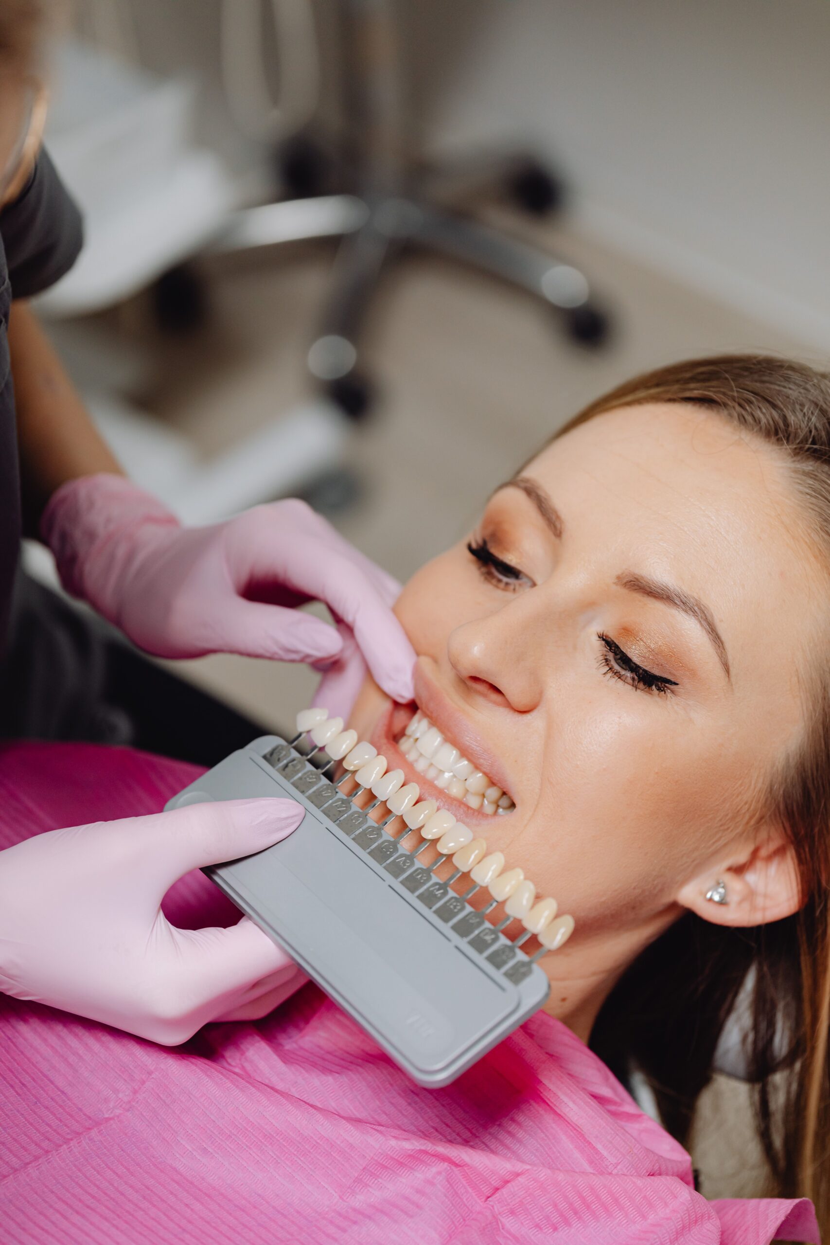 Smile Designing Patient