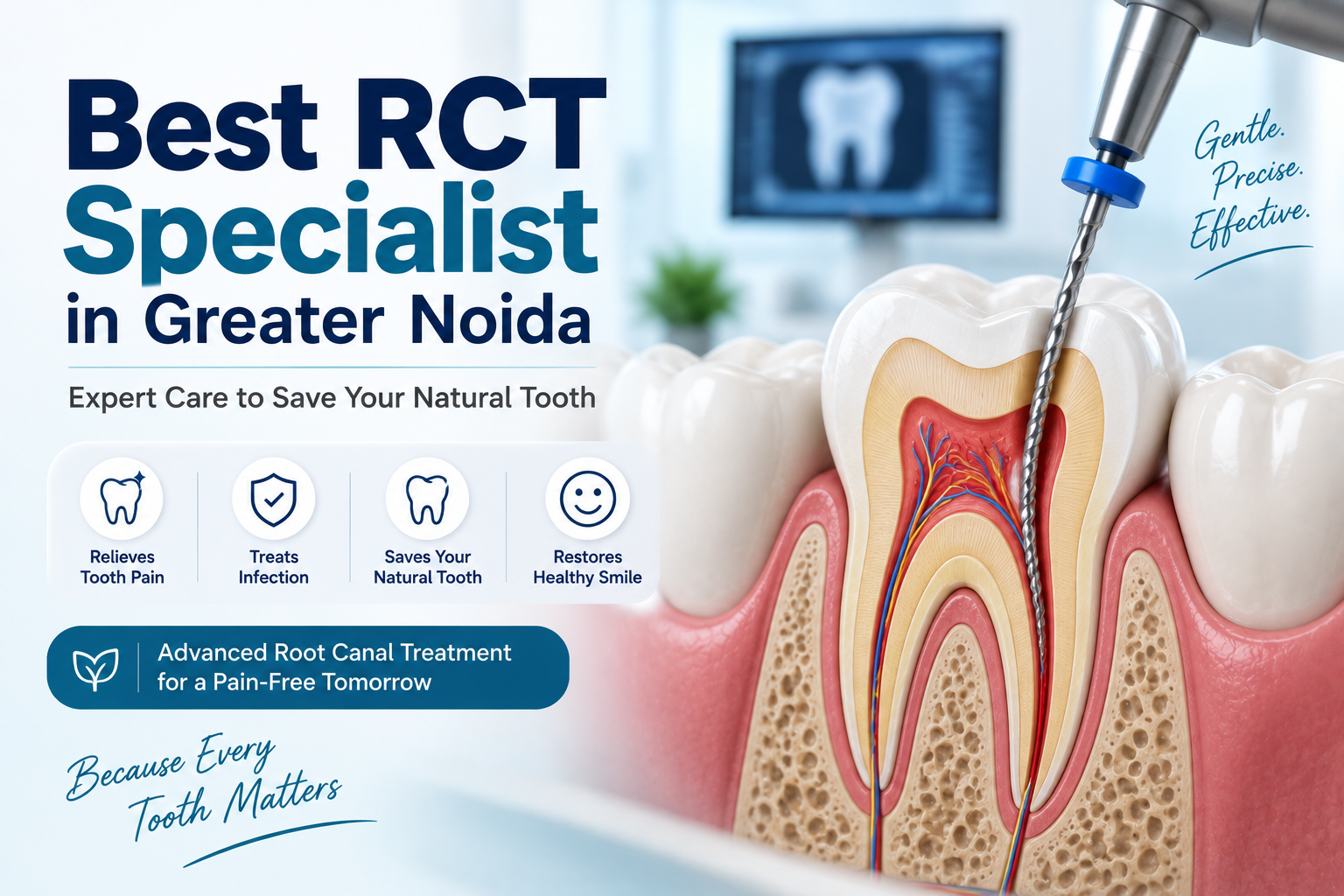 Best RCT Specialist in Greater Noida: How to Choose the Right Root Canal Specialist
